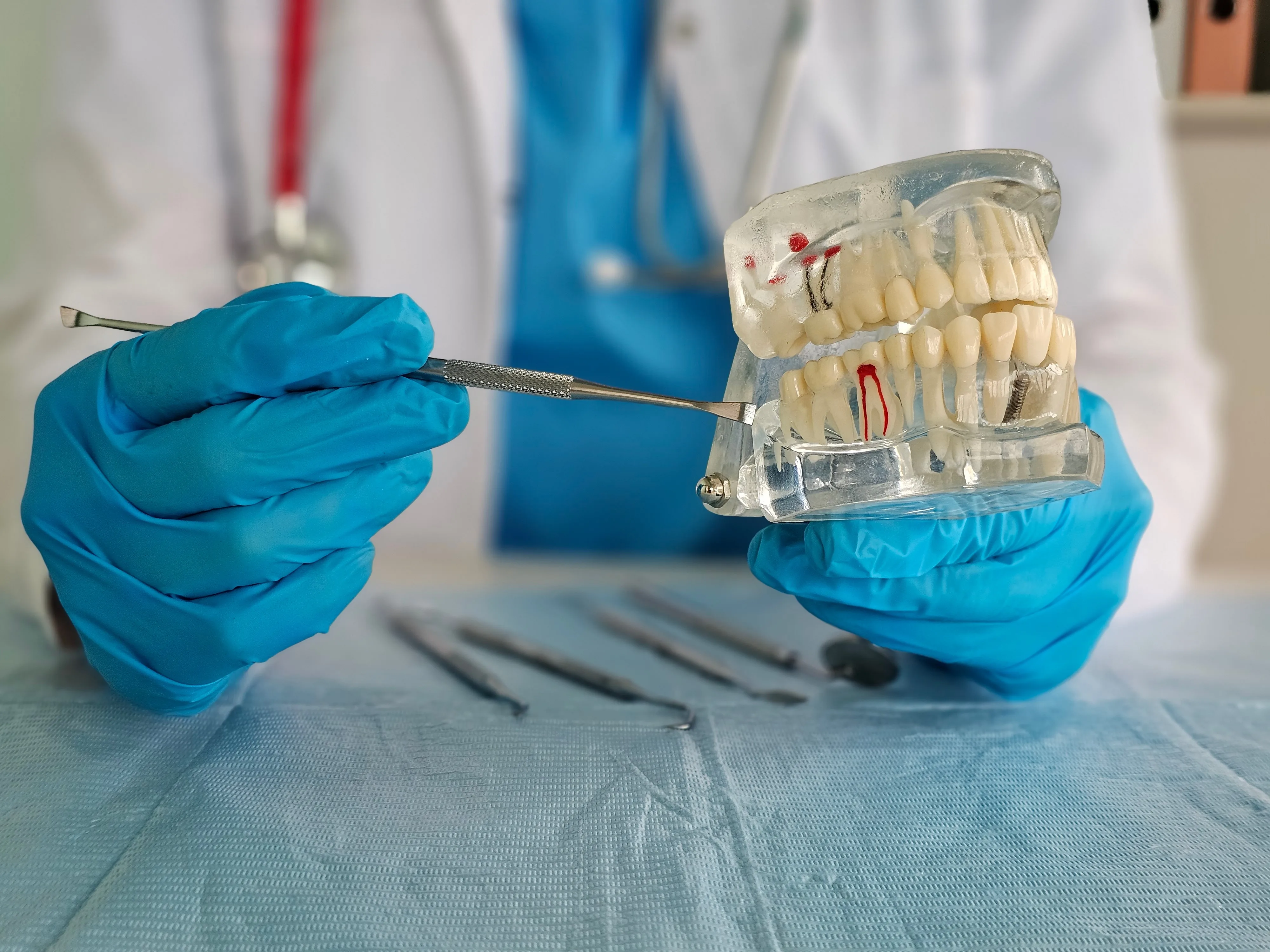 Root canal therapy procedure